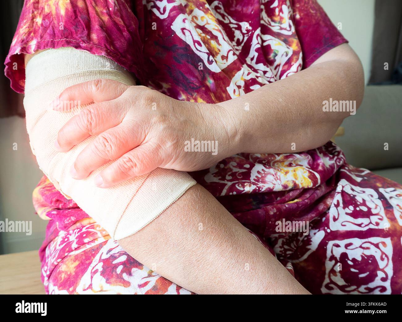 Douleur au coude. Femme tient le coude à cause de la douleur. Coude et avant-bras cassés avec bandage. Avant-bras enveloppé dans un bandage. Attelle pour la récupération et le soulagement de la douleur a Banque D'Images