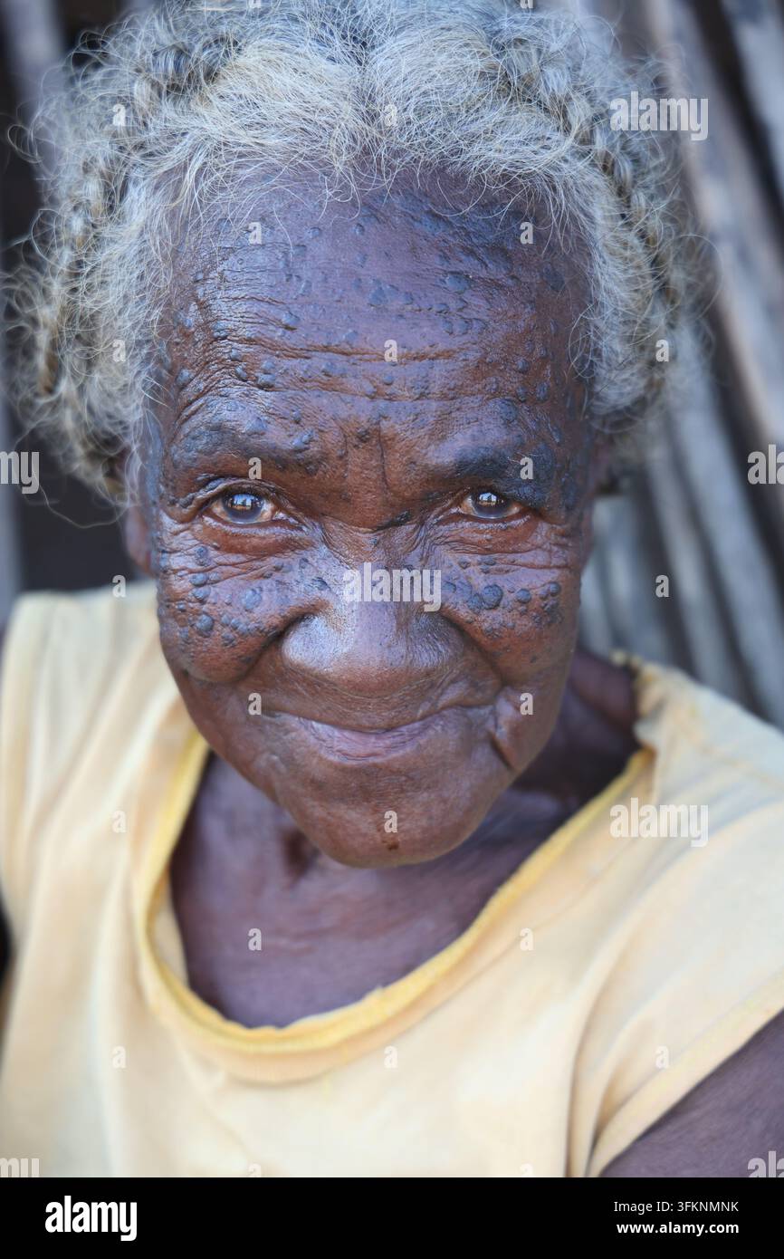 Portrait d'une vieille femme locale à Madagascar Banque D'Images