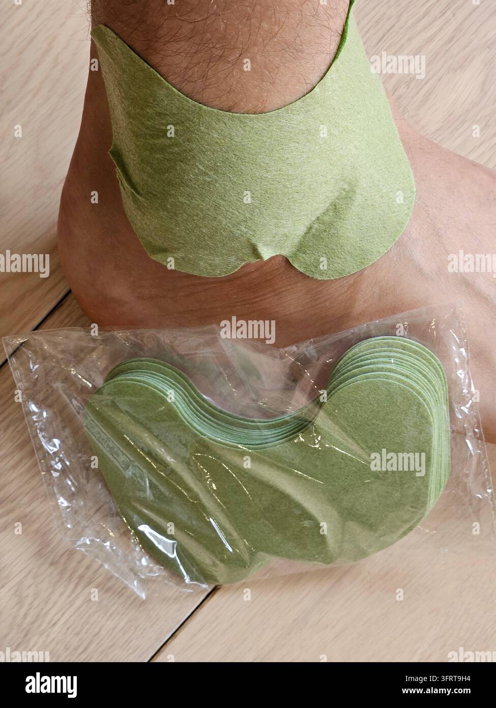 La jambe d'une personne est enveloppée de bandages de couleur verte. Les bandages sont placés autour de la jambe, couvrant un traumatisme sur une partie importante de celle-ci Banque D'Images