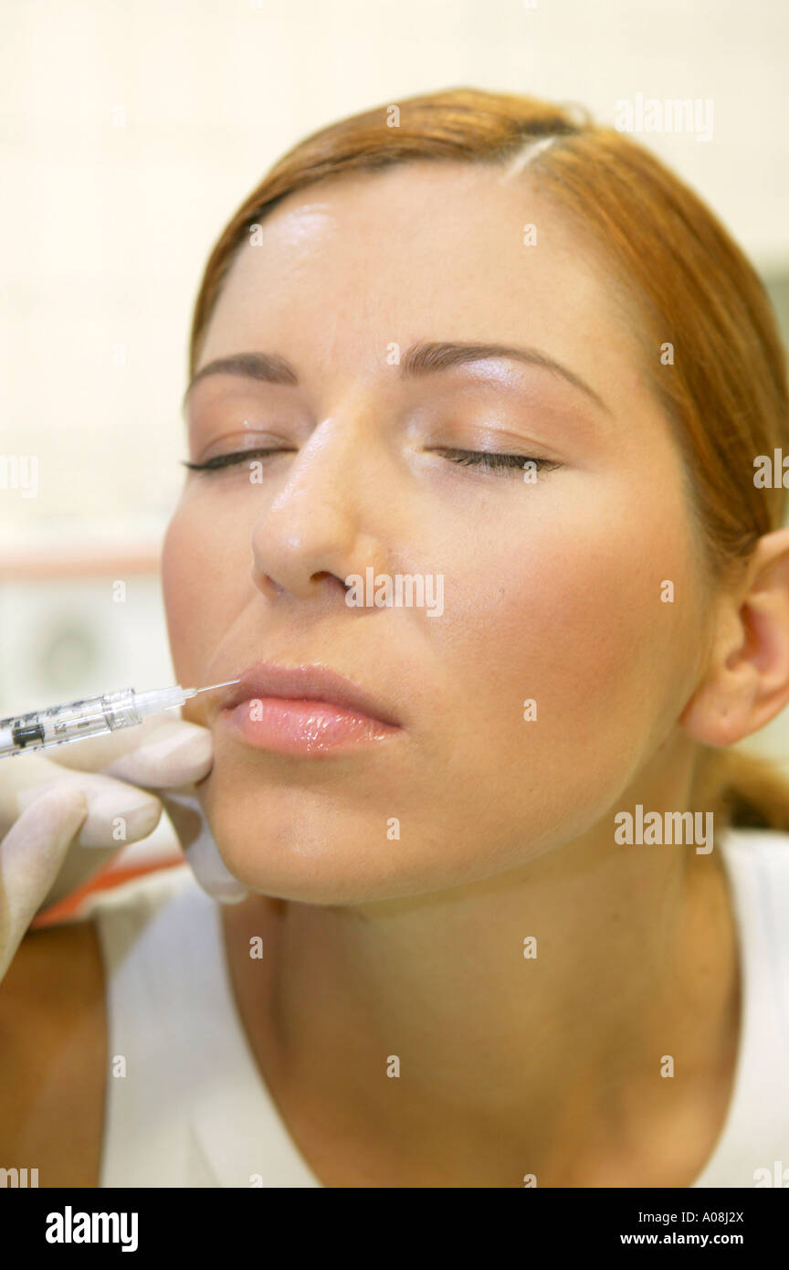 Erhaelt Botoxspritze, eine Frau woman getting a botox injection Banque D'Images