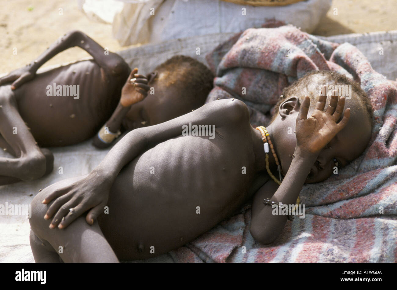 Deux enfants gravement malnutris JETER REPOSANT SUR UNE COUVERTURE AU COURS DE NUTRITION THÉRAPEUTIQUE DE MSF MÉDECINS SANS FRONTIÈRES Banque D'Images Deux enfants gravement malnutris JETER REPOSANT SUR UNE COUVERTURE AU COURS DE NUTRITION THÉRAPEUTIQUE DE MSF MÉDECINS SANS FRONTIÈRES Banque D'Images