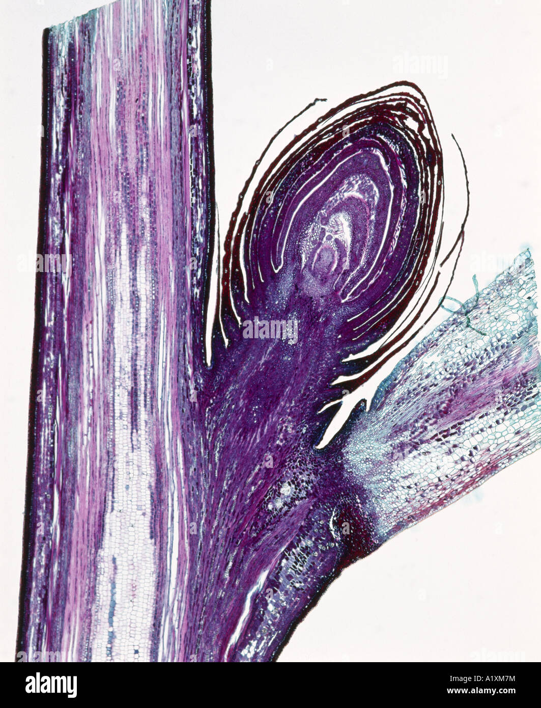 ZONE D'abscission, CERISE (PRUNUS CERASUS) SECTION LONGITUDINALE DU DESSOUS DE LA ZONE D'ABSCISSION DES BUD / 6X Banque D'Images