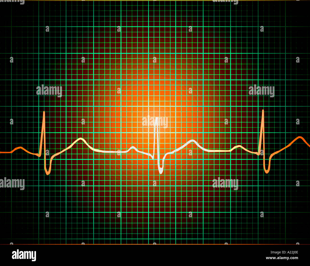 Électrocardiogramme électrocardiogramme projetée sur Grid Banque D'Images