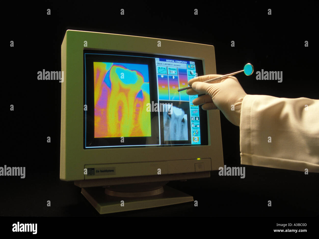 Ordinateur à écran tactile technologie utilisée en cabinet dentaire Banque D'Images