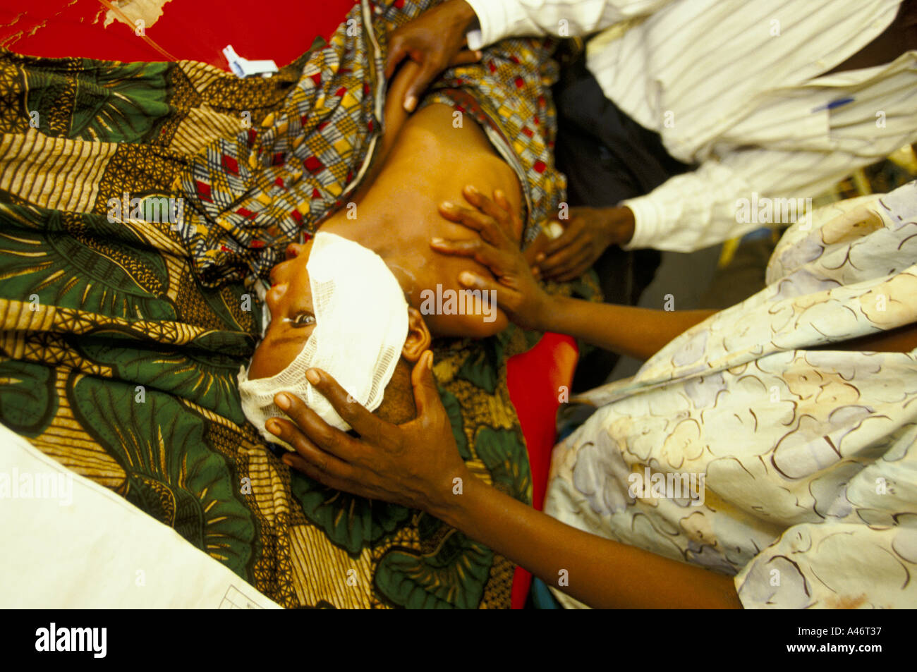 Un enfant blessé dans l'hôpital de Gisenyi dans traités pour blessures après une attaque par des miliciens hutus rwandais de Gisenyi, Interehamwe Banque D'Images