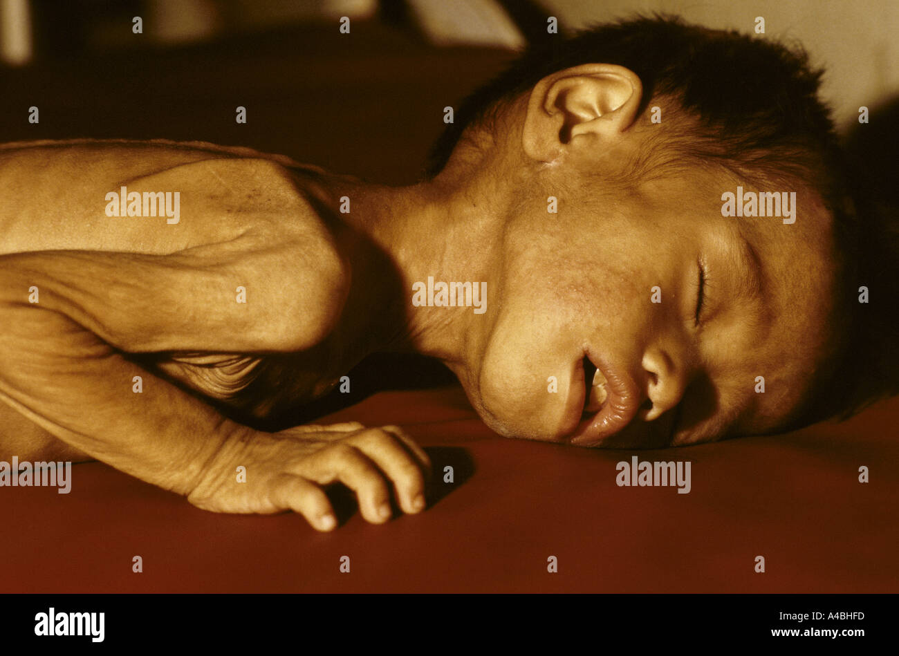 ENFANTS DE GUERRE, HO CHI MINH VILLE Banque D'Images