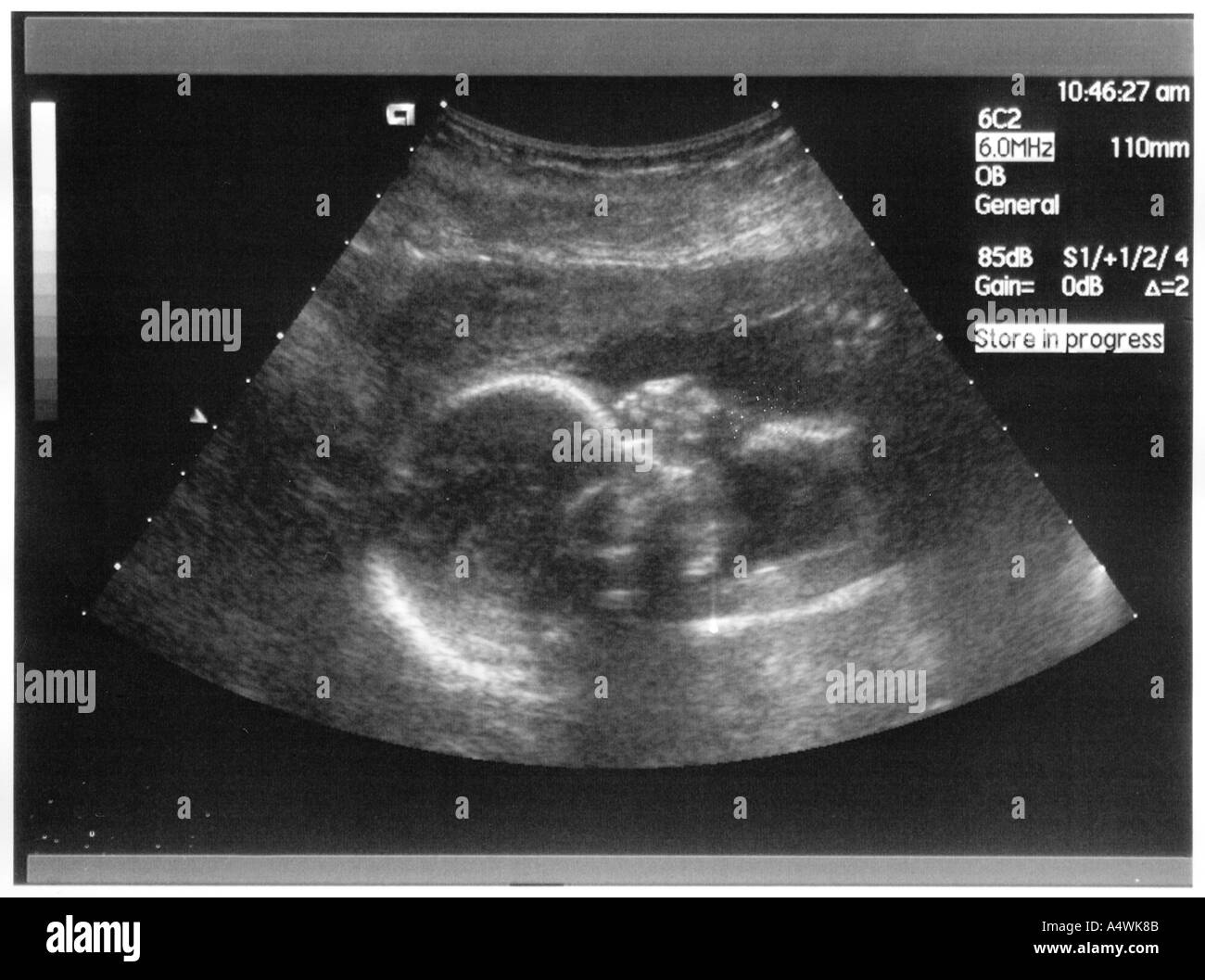 Bebe Echographie Photo Stock Alamy