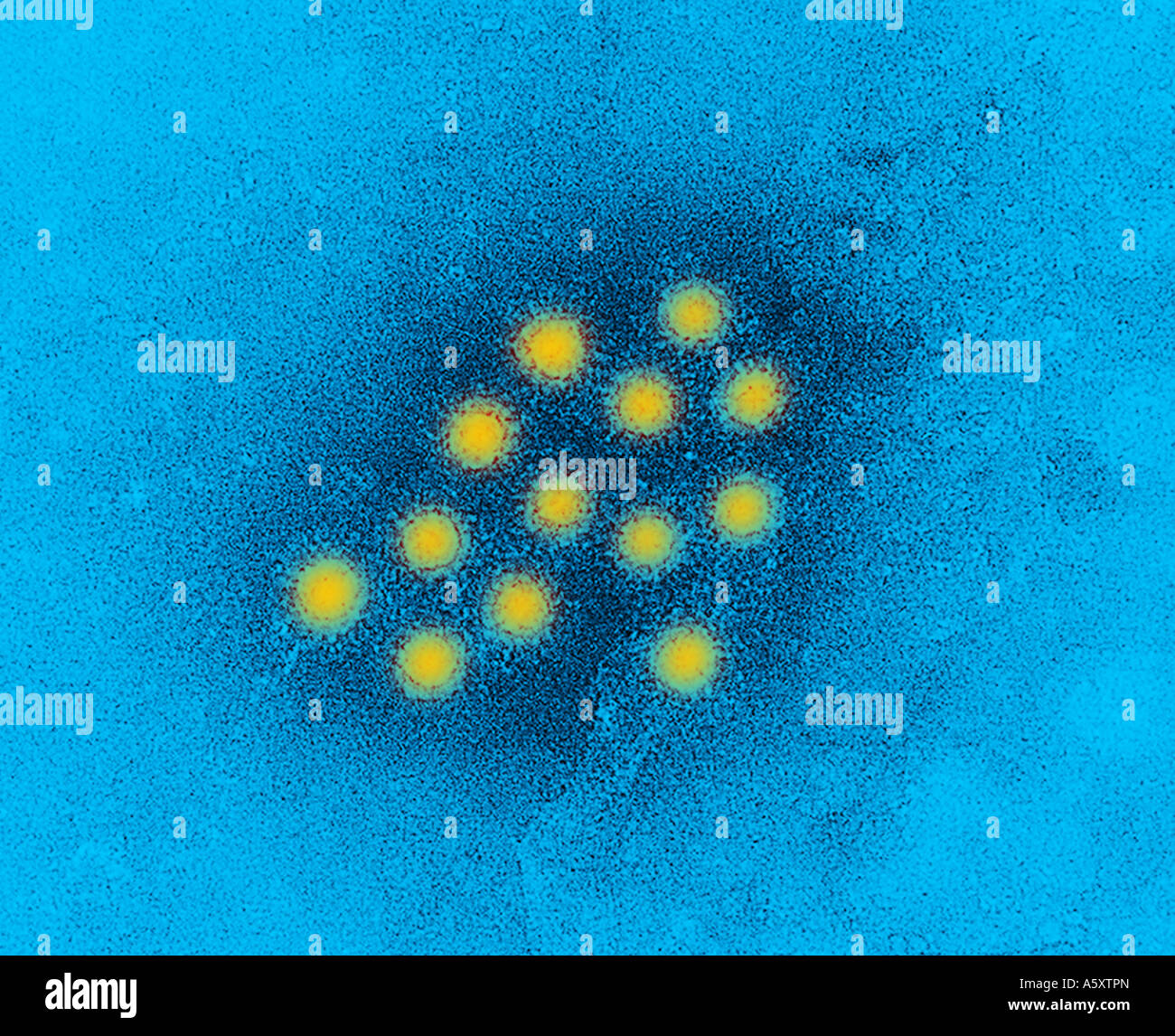 Microscope électronique à transmission, colorés négativement, d'hépatite virale Banque D'Images