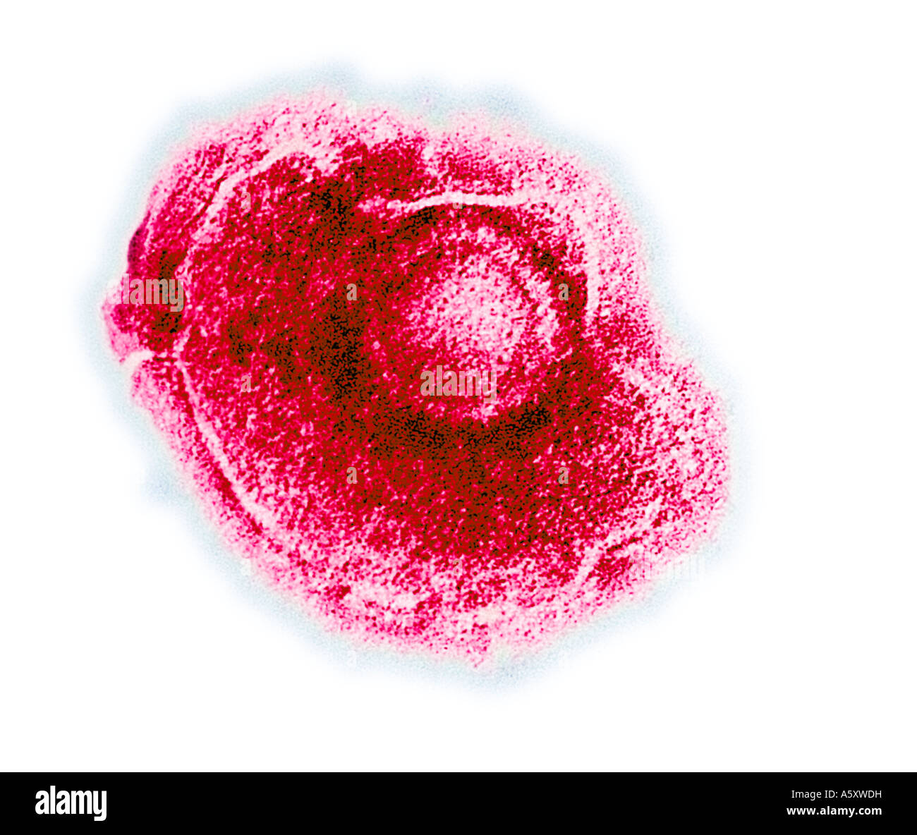 Virus de la varicelle La varicelle Electronmicrograph Banque D'Images