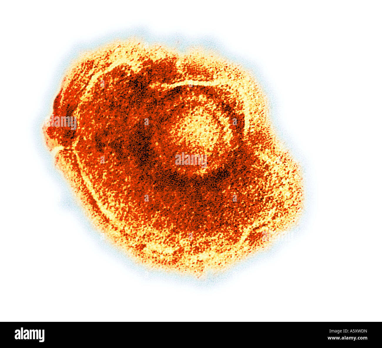 Virus de la varicelle La varicelle Electronmicrograph Banque D'Images