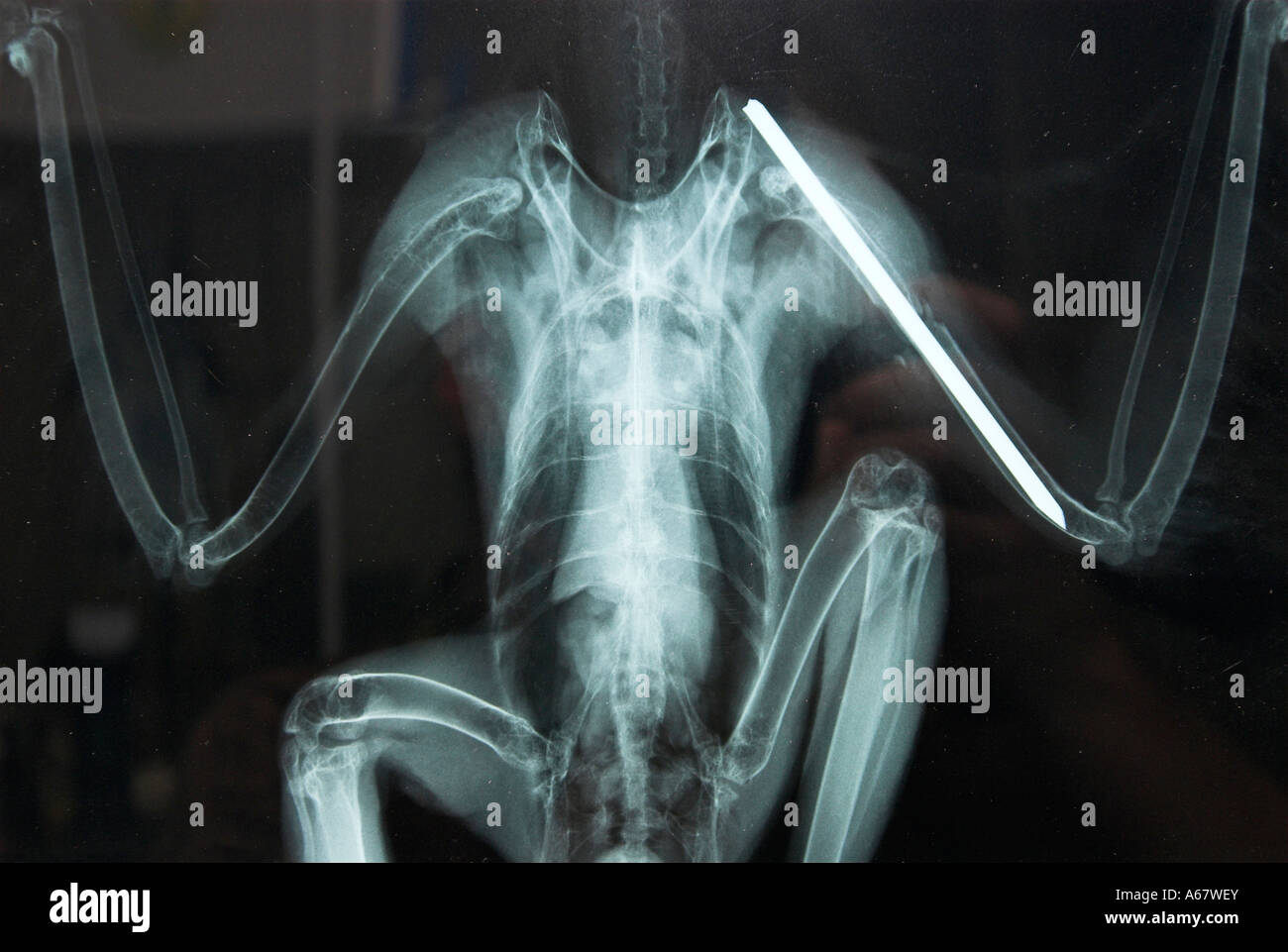 X-Ray d'une aile avec une attelle autour des palombes Banque D'Images