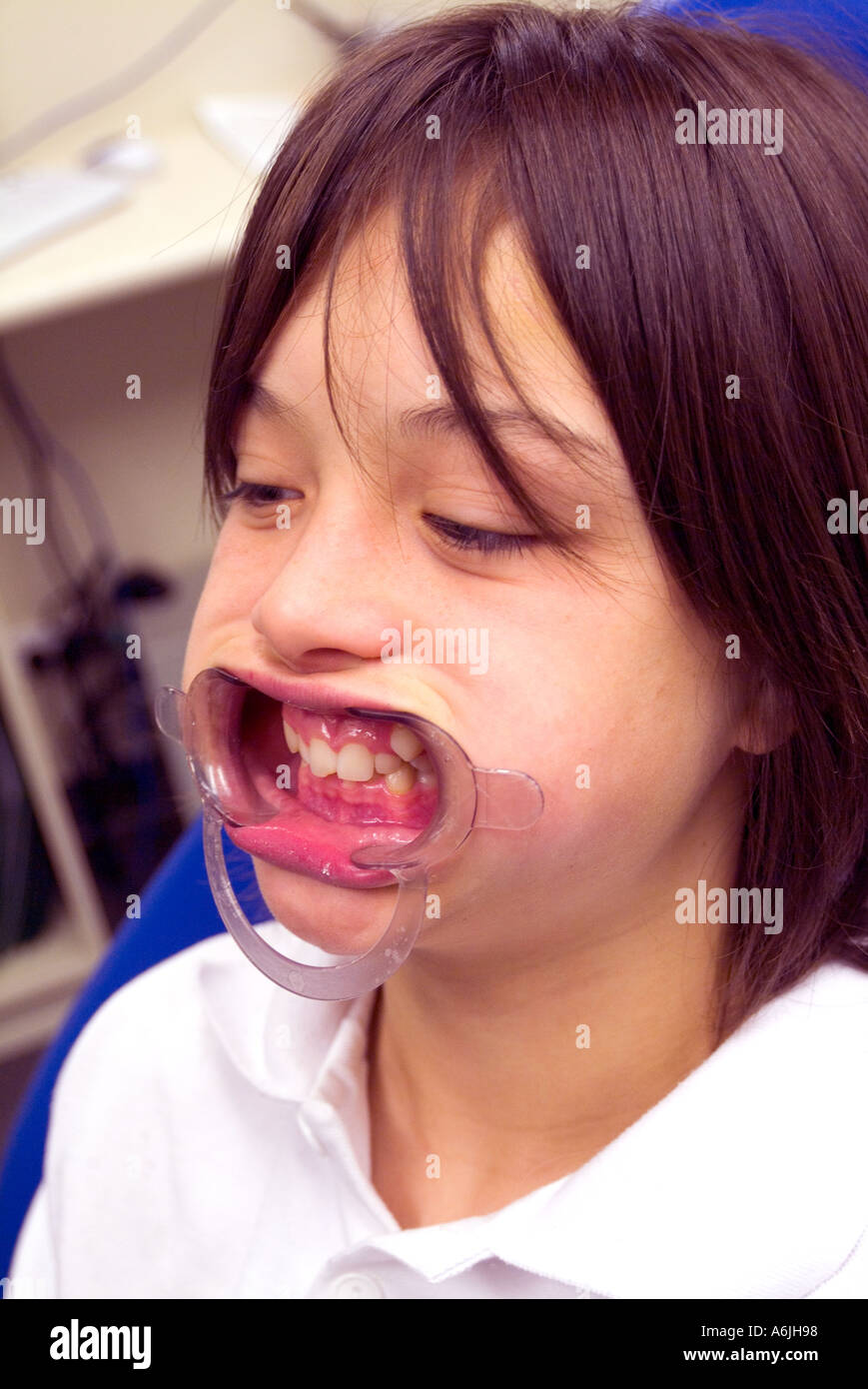 Jeune garçon soumis à évaluation dans la chirurgie de l'orthodontiste s avant d'obtenir l'utilisation de dilatateurs bouche accolades Banque D'Images