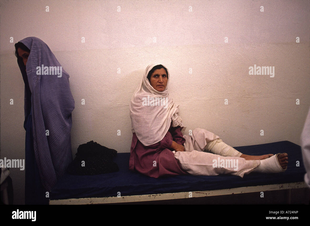 Une collection de jambes prothétiques assemblées dans un atelier, datée de 1992, présentant différentes étapes de réalisation. Banque D'Images