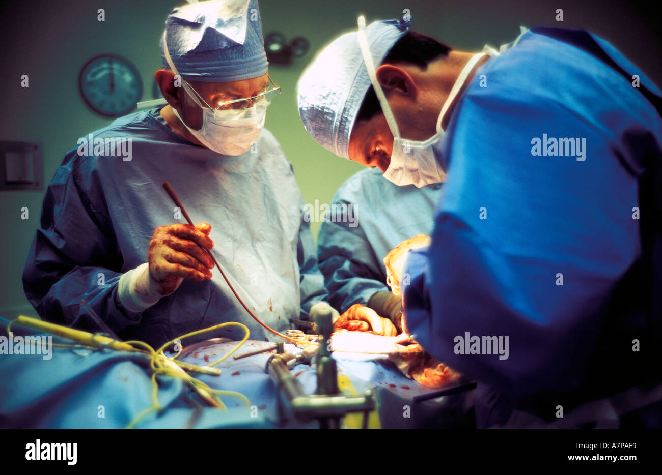Prestation de l'équipe chirurgicale en salle d'opération de transplantation rénale Banque D'Images