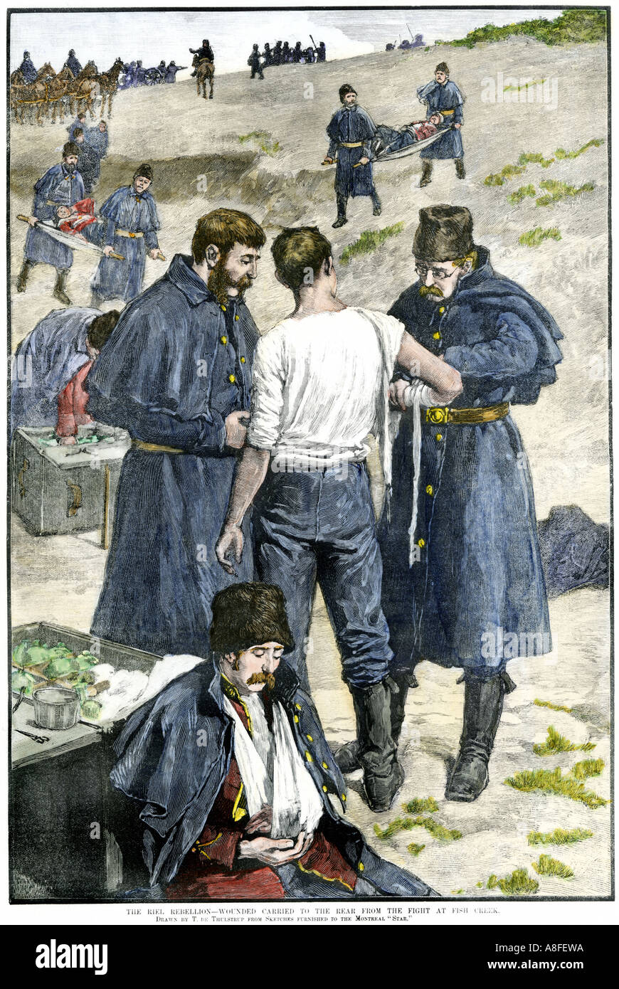 Rébellion de Riel gendarmes canadiens blessés transportés à partir de la bataille de Fish Creek en 1885. À la main, gravure sur bois Banque D'Images