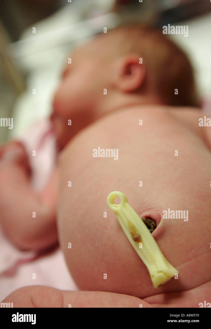 Naissance D Un Bebe Fille Une Semaine Dans Lit Bebe Avec Collier Sur Cordon Ombilical Photo Stock Alamy