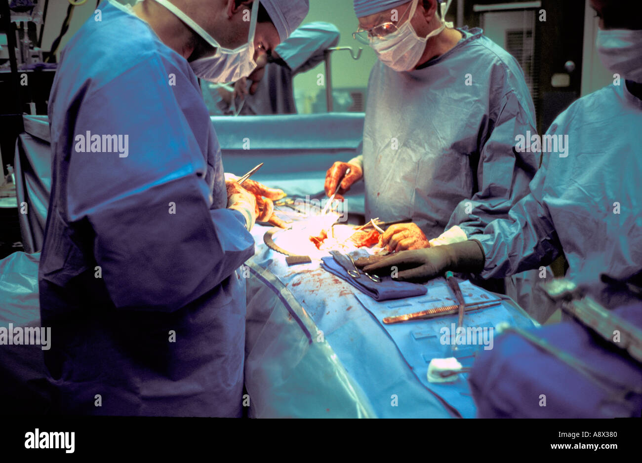 Prestation de l'équipe chirurgicale en salle d'opération de transplantation rénale Banque D'Images