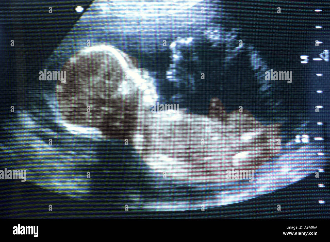 5 A 7 Mois Le Fœtus Vu Lors D Echographie Photo Stock Alamy