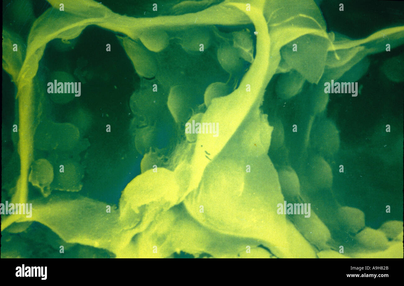 SEM scientifique de cellules végétales montre des chloroplastes et des murs du cellule mag x 2190 1 95 9 33 Banque D'Images