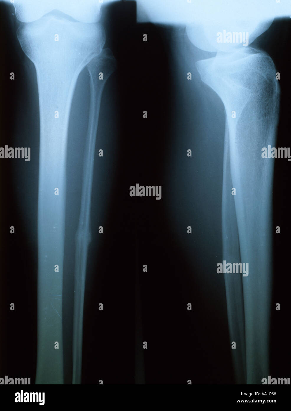 Xray des droits de membre, Banque D'Images