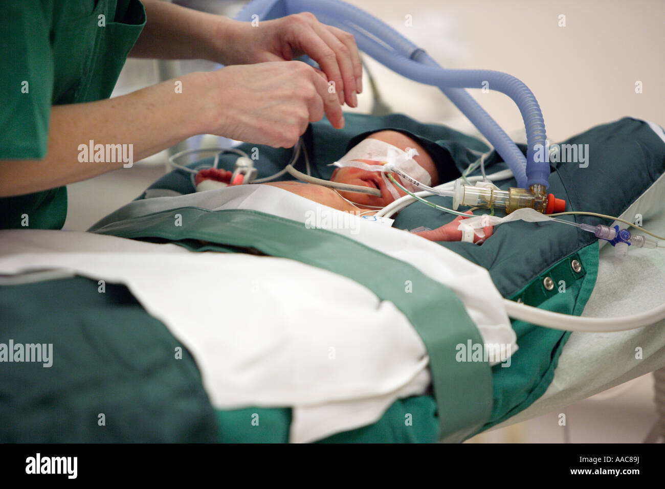 Altona centre hospitalier pour enfants Un bébé sur la table d'opération le patient est de 14 jours Banque D'Images