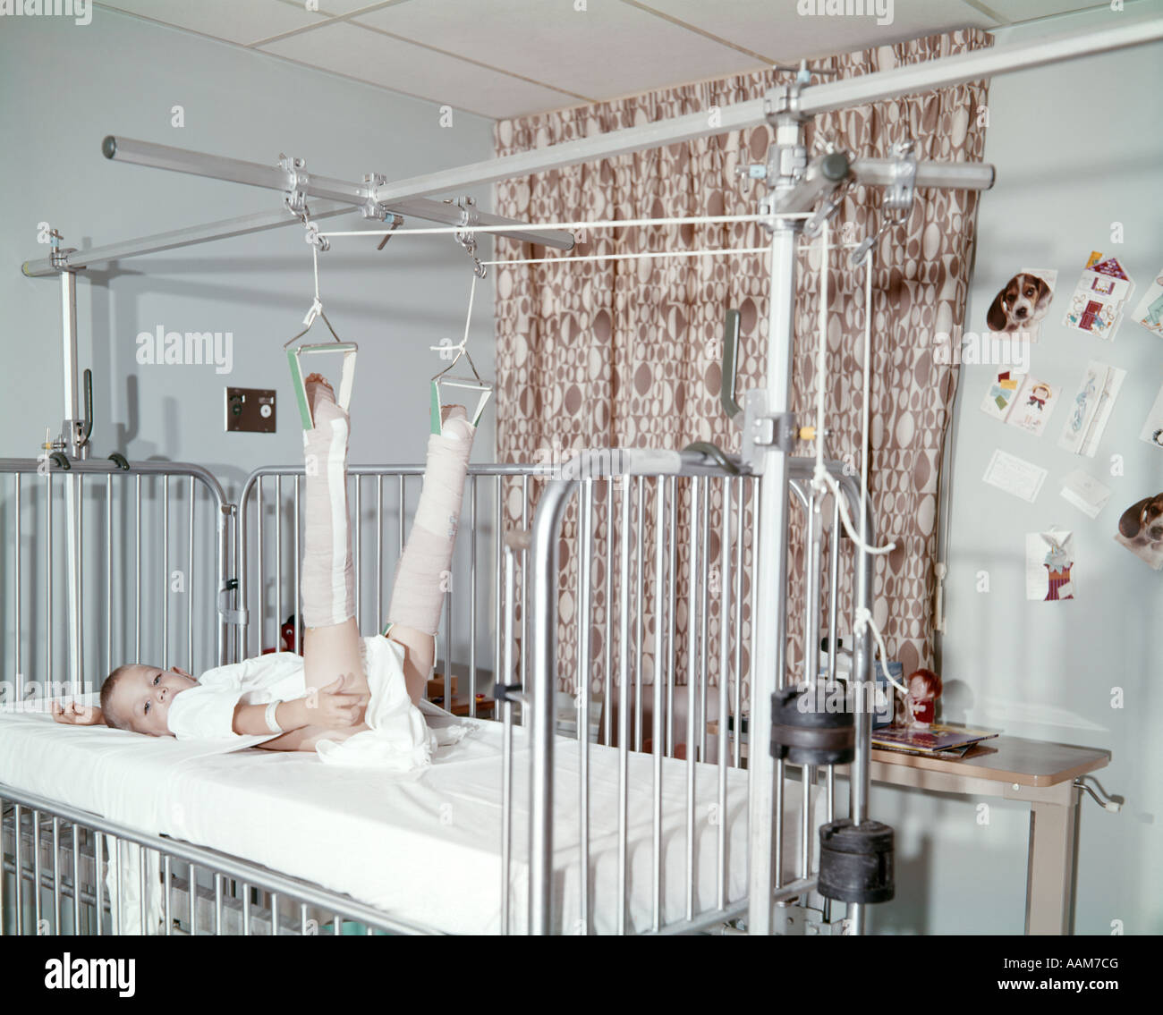 1960 BOY CHILD IN HOSPITAL BED TRACTION AVEC DEUX jambes cassées LOOKING AT CAMERA Banque D'Images