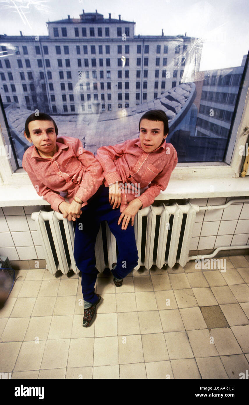 Jumeaux siamois russe masha et dasha krivoshlyapova à Moscou Banque D'Images