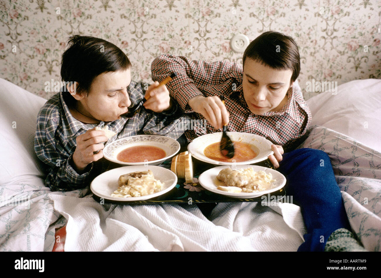 Jumeaux siamois russe masha et dasha krivoshlyapova à Moscou Banque D'Images