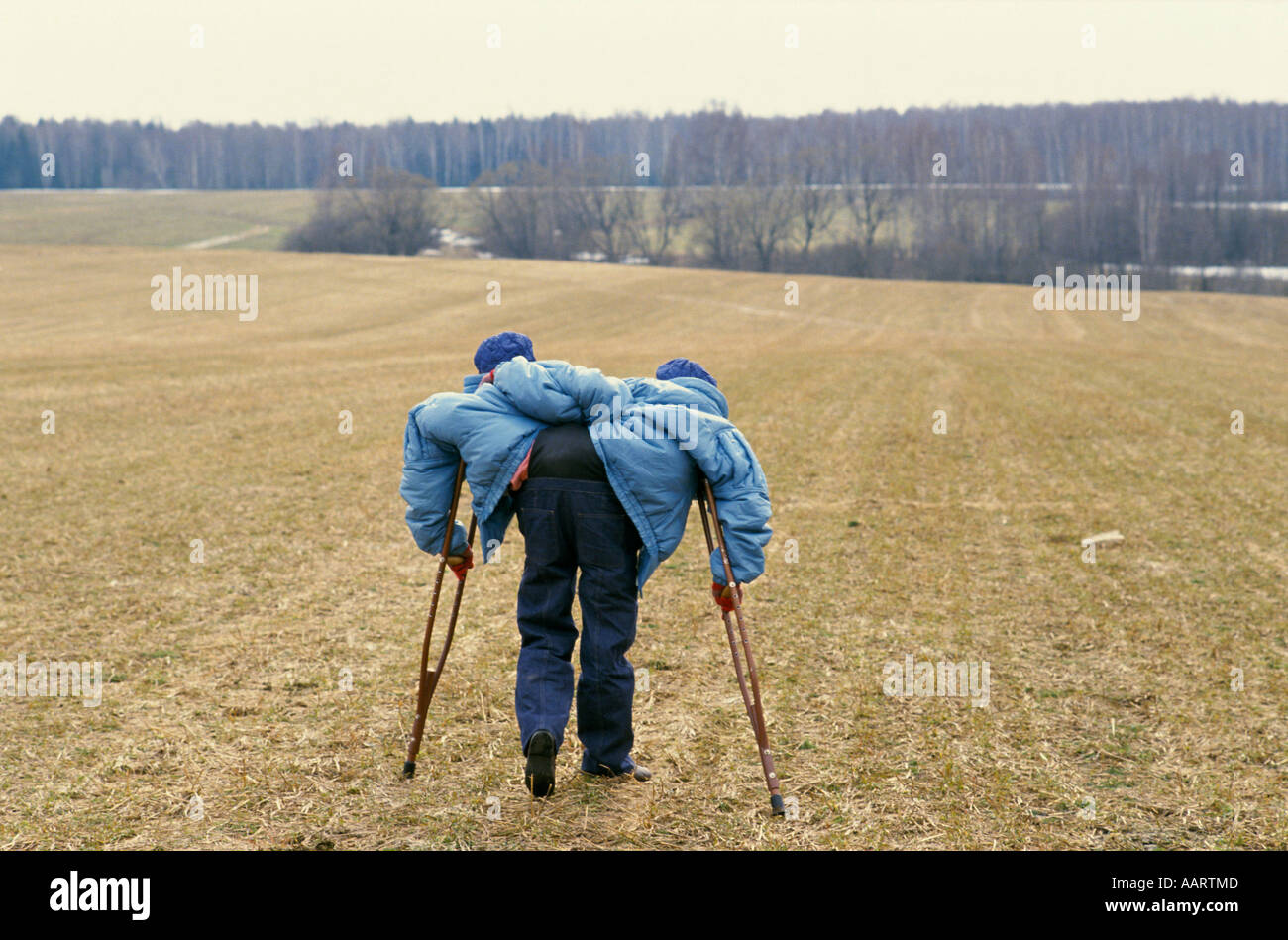 Jumeaux siamois russe masha et dasha krivoshlyapova à Moscou Banque D'Images