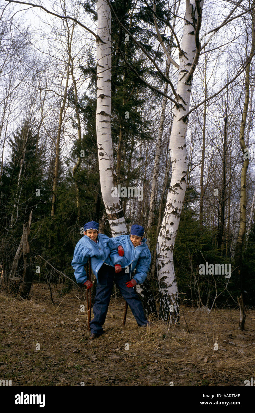 Jumeaux siamois russe masha et dasha krivoshlyapova à Moscou Banque D'Images