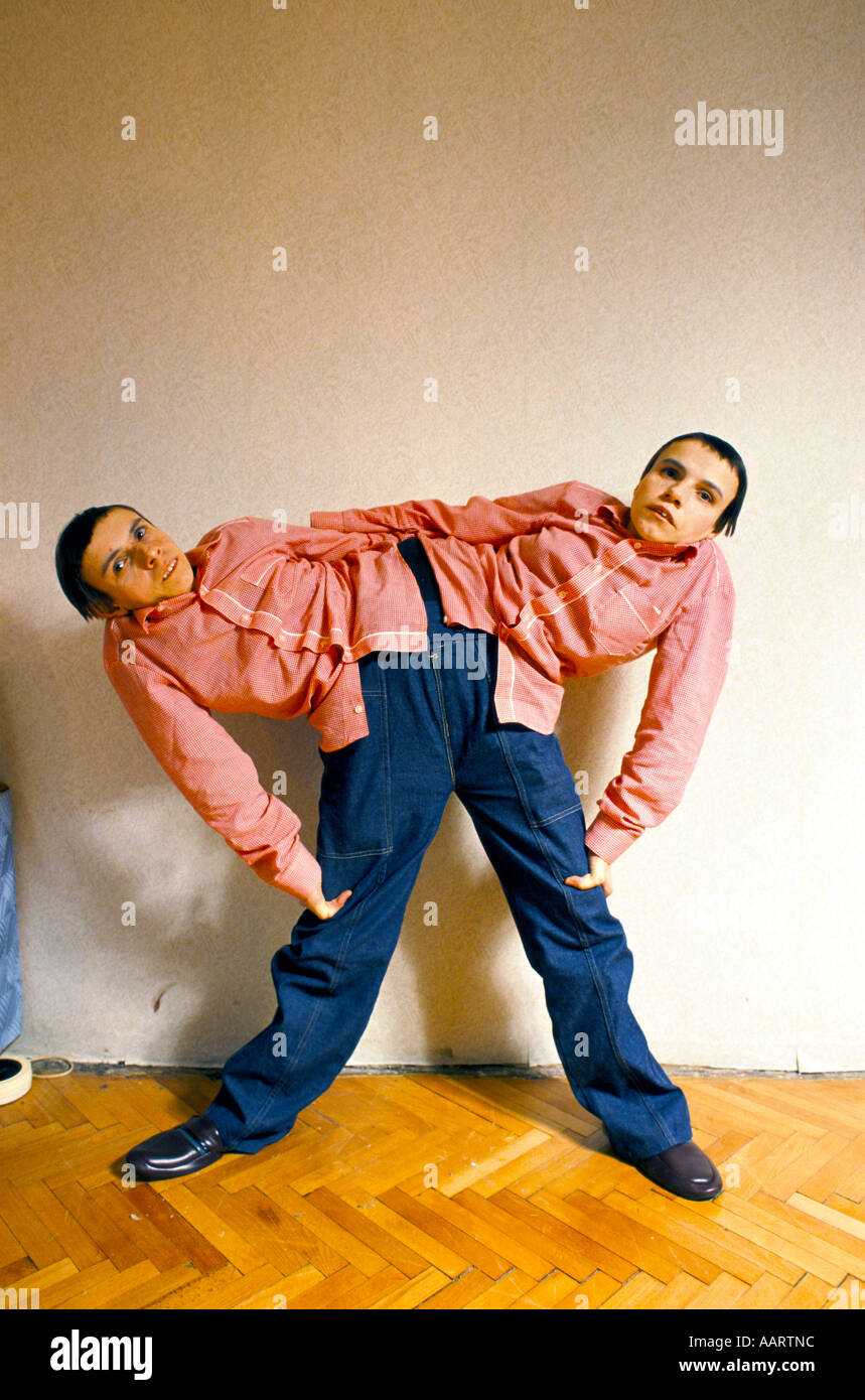 Jumeaux siamois russe masha et dasha krivoshlyapova à Moscou Banque D'Images