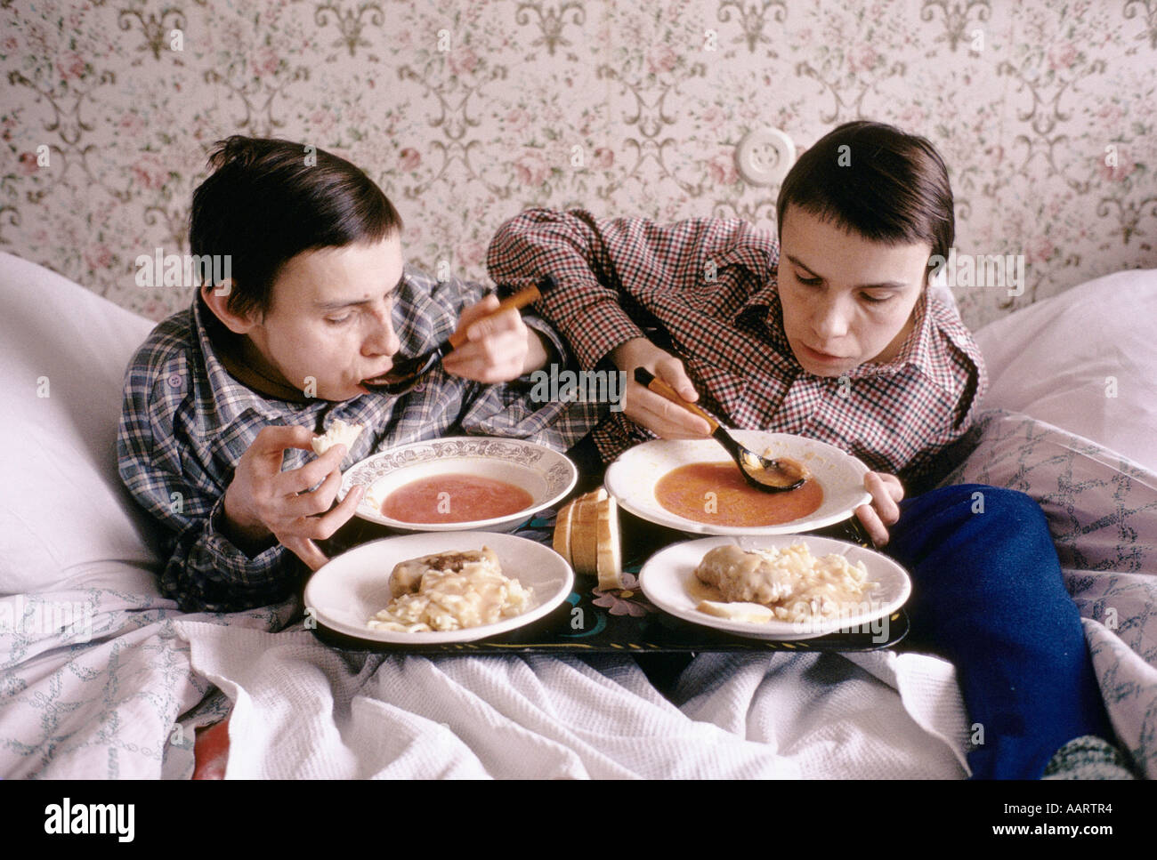 Jumeaux siamois russe masha et dasha krivoshlyapova à Moscou Banque D'Images