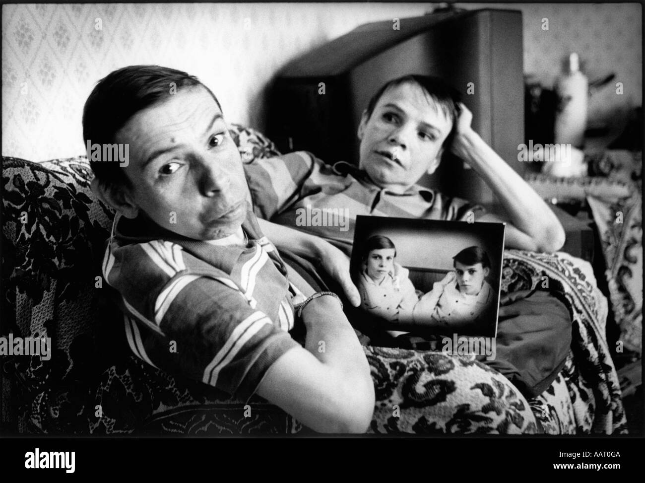 Jumeaux siamois russe masha et dasha krivoshlyapova à Moscou Banque D'Images