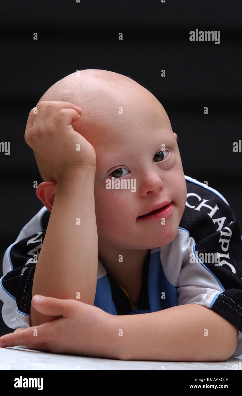 Enfant mignon avec un syndrome de Down syndrome portrait Banque D'Images