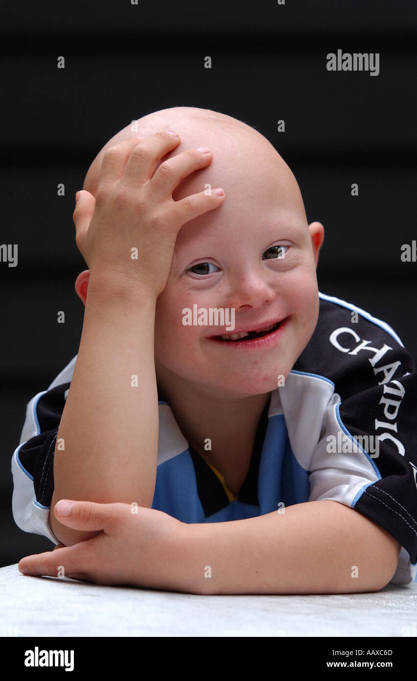 Grand sourire mignon enfant avec un syndrome de Down syndrome portrait Banque D'Images