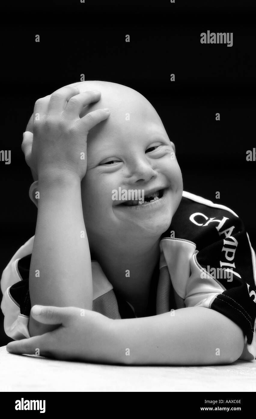 Sourire sourire mignon enfant avec un syndrome de Down syndrome portrait Banque D'Images
