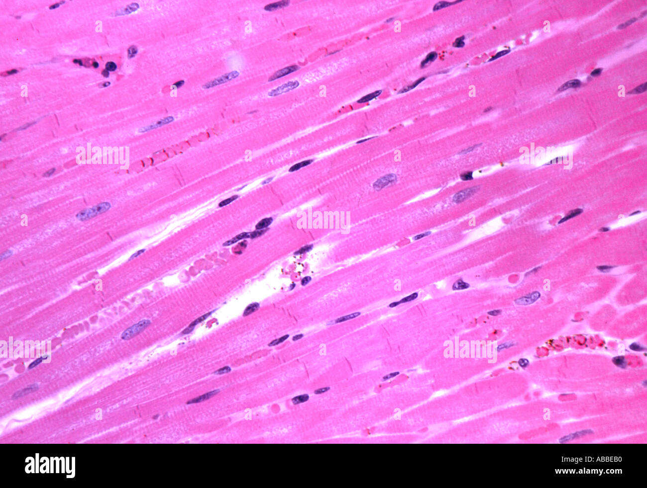 Le muscle cardiaque section semithin Fond clair tachés HFW 350UM Banque D'Images Le muscle cardiaque section semithin Fond clair tachés HFW 350UM Banque D'Images