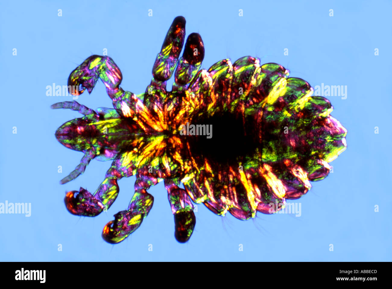 Pou crabe Phithirus pubis plaque teinte sensible 5.2.11 remplir Banque D'Images Pou crabe Phithirus pubis plaque teinte sensible 5.2.11 remplir Banque D'Images