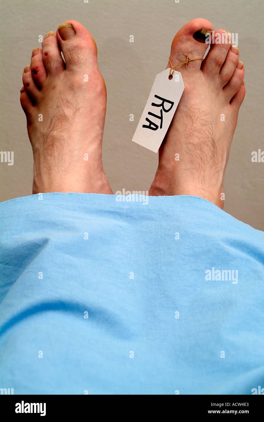 Appelée pied d'un cadavre dans une morgue après un accident de voiture mortel Banque D'Images