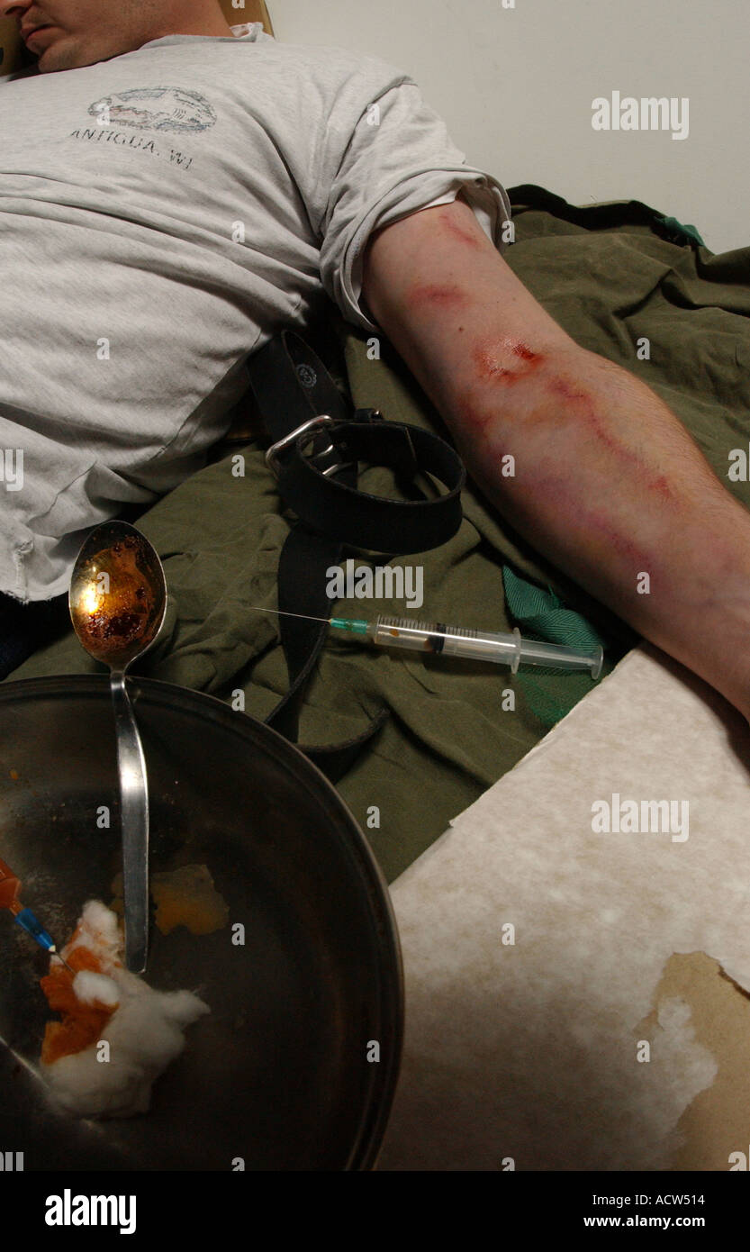Un héroïnomane souffrant d'une overdose après une correction de la drogue à travers une aiguille hypodermique (posé par modèle) Banque D'Images