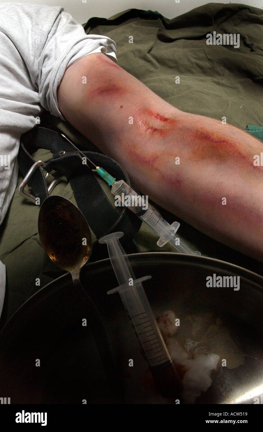 Un héroïnomane souffrant d'une overdose après une correction de la drogue à travers une aiguille hypodermique (posé par modèle) Banque D'Images