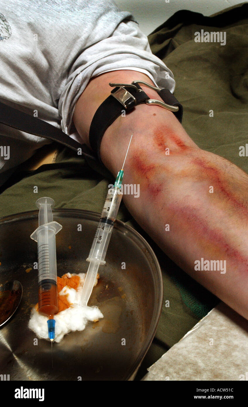 Un héroïnomane souffrant d'une overdose après une correction de la drogue à travers une aiguille hypodermique (posé par modèle) Banque D'Images
