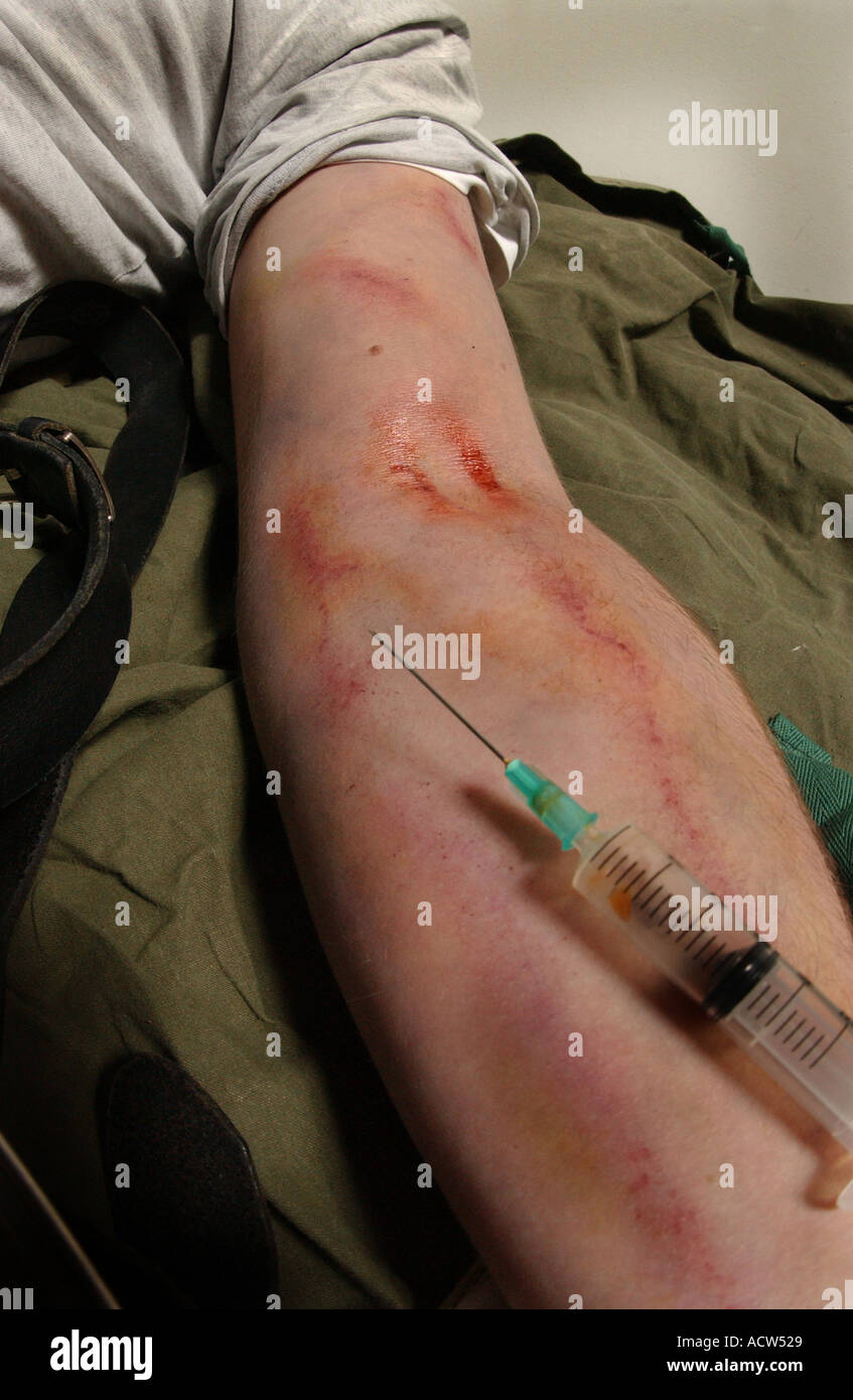 Un héroïnomane souffrant d'une overdose après une correction de la drogue à travers une aiguille hypodermique (posé par modèle) Banque D'Images
