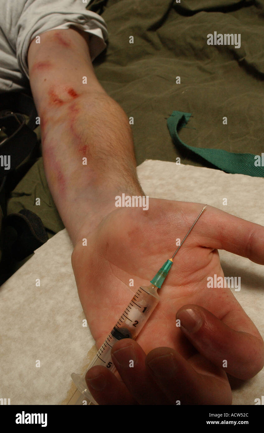 Un héroïnomane souffrant d'une overdose après une correction de la drogue à travers une aiguille hypodermique (posé par modèle) Banque D'Images