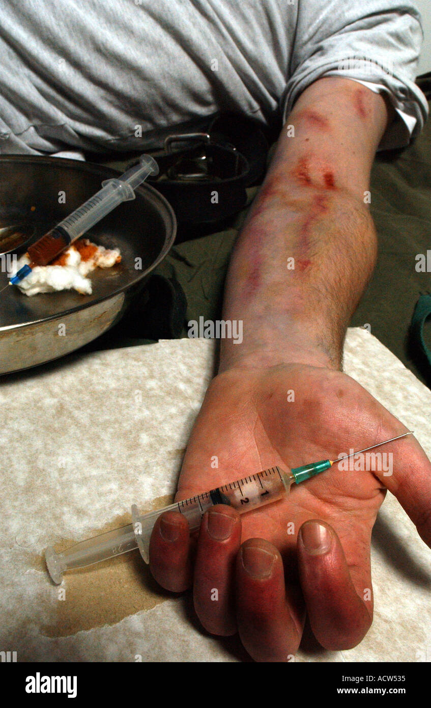 Un héroïnomane souffrant d'une overdose après une correction de la drogue à travers une aiguille hypodermique (posé par modèle) Banque D'Images