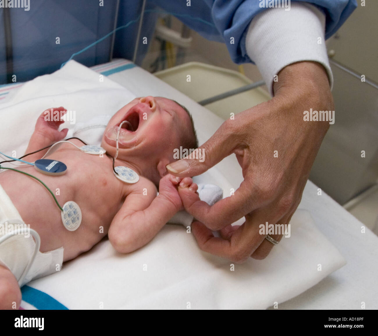 Bebe Premature Dans Un Style Neo Natal Unite A Un Hopital Dans La Ville De New York Est En Bonne Voie D Avoir Ete Nes Apres Seulement 27 Semaines Photo Stock Alamy Bebe Premature Dans Un Style Neo Natal Unite A Un Hopital Dans La Ville De New York Est En Bonne Voie D Avoir Ete Nes Apres Seulement 27 Semaines Photo Stock Alamy