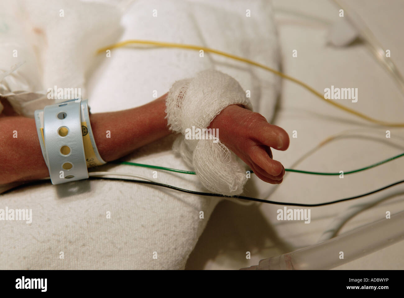 Attaché à l'oxymètre de pouls enfant prématuré au pied de l'unité néonatale de soins intensifs Banque D'Images