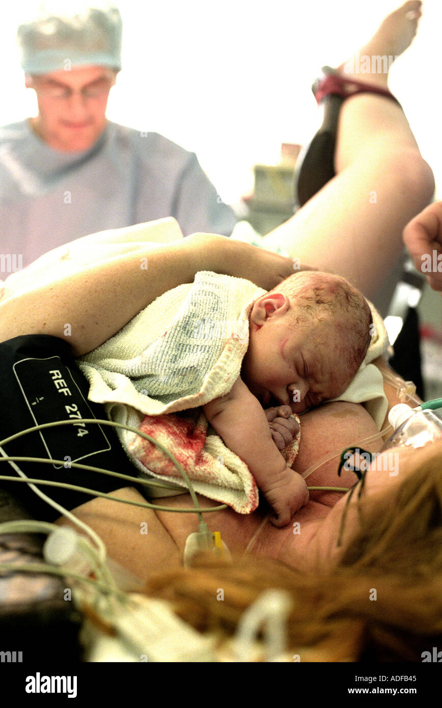Mère regardant bébé nouveau-né après accouchement par forceps dans l'exploitation de l'hôpital Kings Theatre à Londres, chirurgien suture . Banque D'Images