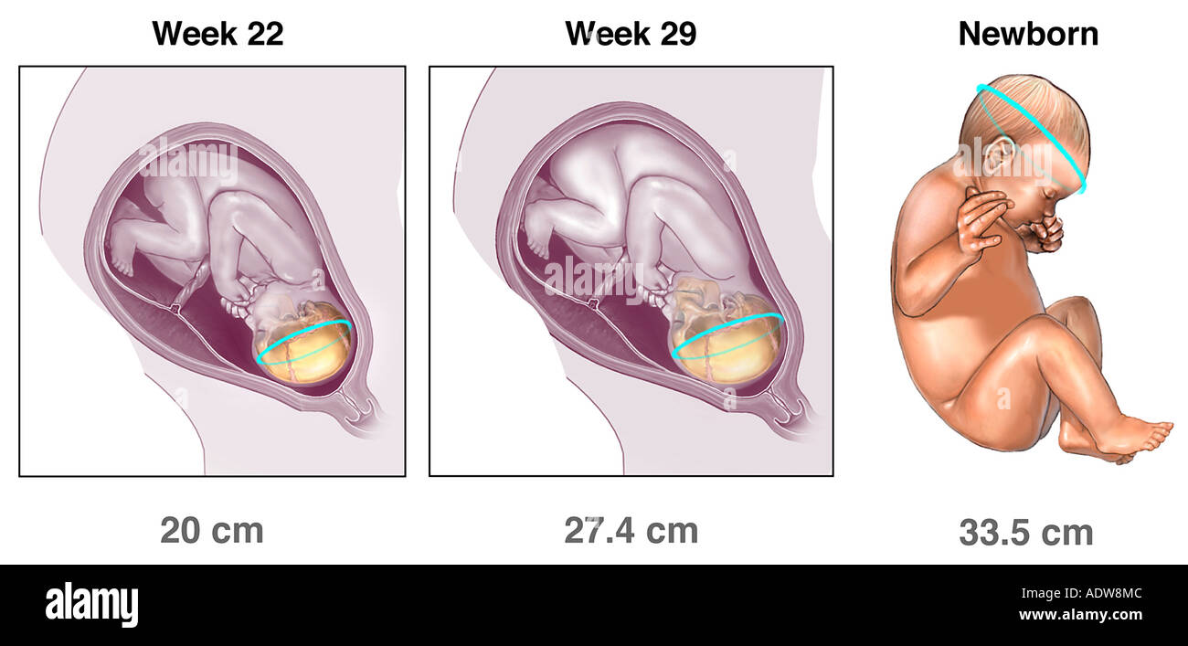 Les Mesures De La Circonference De La Tete Du Foetus A 22 Semaines 29 Semaines Et Du Nouveau Ne Photo Stock Alamy