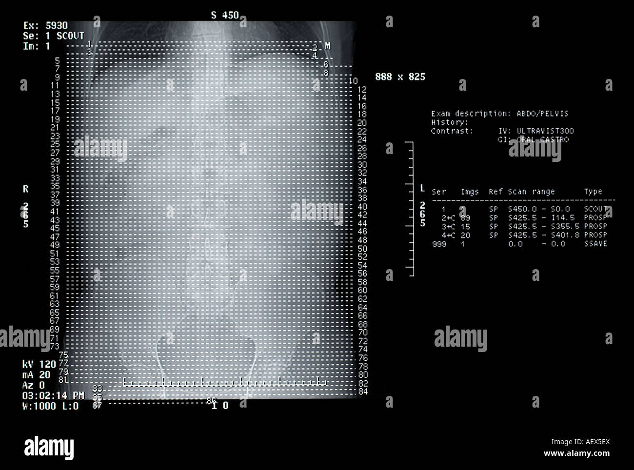 CT scan de haut du corps Banque D'Images